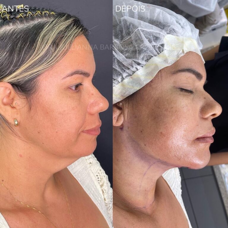 Snapinsta.app_320606440_699039618280385_4452954126101960542_n_1080