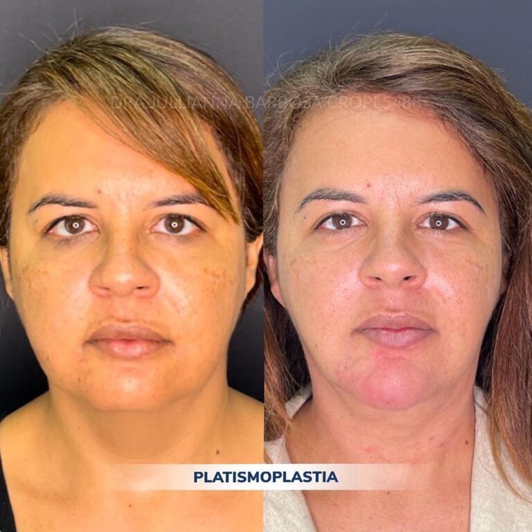 Snapinsta.app_332378881_924545021923330_8772568878508237160_n_1080